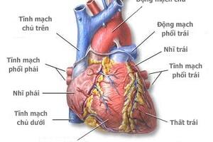 Tim mạch can thiệp - một bước tiến lớn của Ngành Tim mạch ở Việt Nam