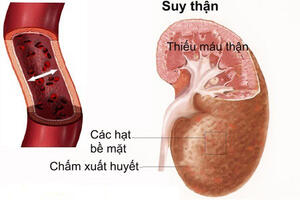 Mất nước và những nguy cơ tiềm ẩn