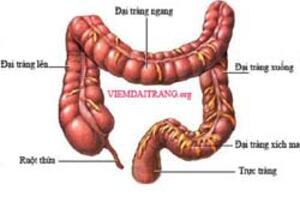 4 nguyên tắc điều trị viêm đại tràng.