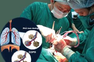 Ðột phá trong điều trị bệnh phổi tắc nghẽn mạn tính
