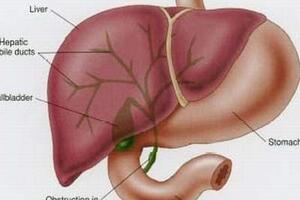 Phân biệt teo đường mật bẩm sinh với vàng da sinh lý