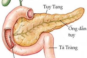 Tiền đái tháo đường