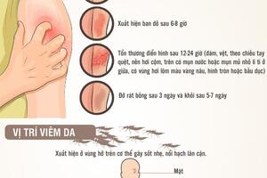 Hướng dẫn toàn diện phòng chống kiến ba khoang