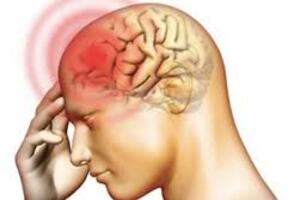 Bệnh viêm não, màng não do mô cầu
