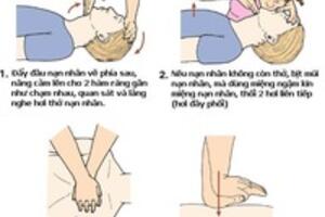 Nhận biết và sơ cứu cơn đau tim