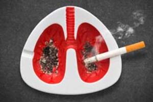 Thuốc lá là nguyên nhân gây nhiều bệnh nguy hiểm cho sức khỏe