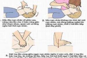 Cách hô hấp nhân tạo và xoa bóp tim ngoài lồng ngực