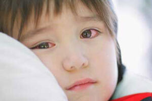 Bộ Y tế khuyến cáo phòng bệnh đau mắt đỏ