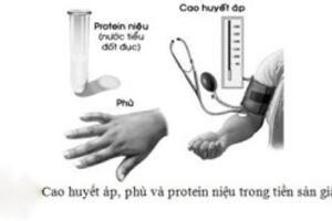 Tiền sản giật có thể gây tử vong cho cả mẹ lẫn thai nhi