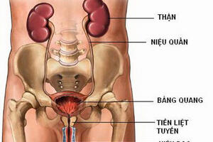 Dùng thuốc trị nhiễm khuẩn tiết niệu