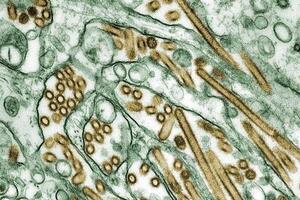 Cúm gia cầm A/H10N8 có gì lạ?