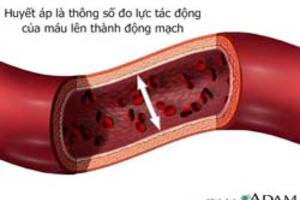 Những biến chứng nguy hiểm của bệnh tăng huyết áp