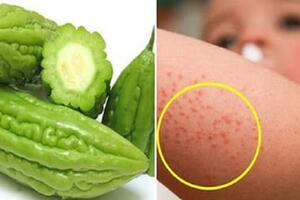 6 bệnh da liễu hay gặp trong mùa nắng nóng
