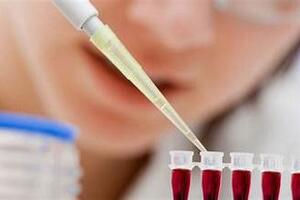 Phương pháp mới phát hiện tế bào gốc ung thư giúp tiên lượng sớm  ung thư tái phát