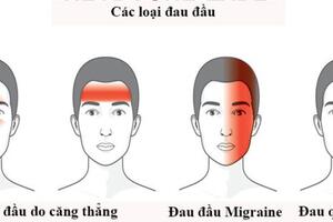 4 loại đau đầu thường gặp nhiều người chưa biết