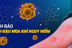 Bài phát thanh phòng chống bệnh Đậu mùa khỉ