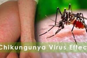 Tình hình dịch bệnh Chikungunya