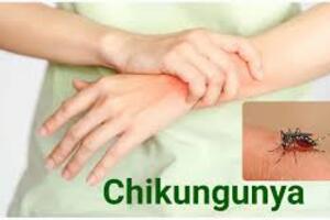 video -  Bộ Y tế yêu cầu tăng cường công tác phòng, chống bệnh Chikungunya