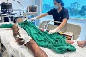 Chăm sóc bệnh nhân nhiễm liên cầu lợn - Cẩn trọng để bảo toàn sức khỏe và phòng ngừa lây lan