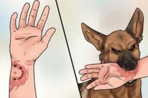 Hướng dẫn chỉ định điều trị dự phòng bệnh Dại