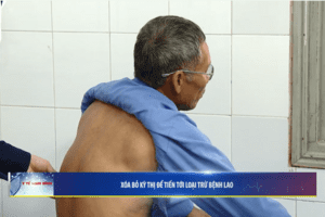 Bệnh viện Phổi xoá bỏ kỳ thị để loại trừ bệnh Lao