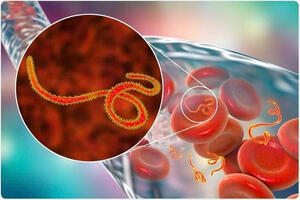 Chủ động phòng, chống dịch bệnh Ebola - Bảo vệ sức khỏe cộng đồng