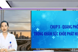 Video -  CHỤP X - QUANG PHỔI TRONG KHÁM SỨC KHỎE PHÁT HIỆN NHỮNG GÌ