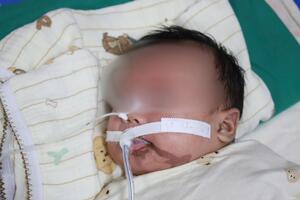 Bệnh viện Sản Nhi tỉnh Ninh Bình cấp cứu thành công trường hợp trẻ 1 tháng tuổi bị người lớn nhỏ nhầm axit vào miệng