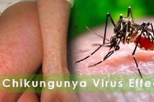 Dịch bệnh Chikungunya tăng tại nhiều nước, Bộ Y tế khuyến cáo khẩn các biện pháp phòng, chống