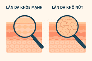 BÍ QUYẾT "VÀNG" CHĂM SÓC VÀ BẢO VỆ LÀN DA KHỎE MẠNH TRONG MÙA LẠNH