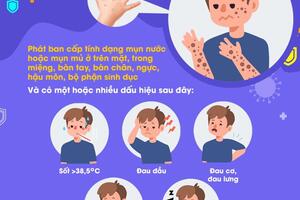 Nhận biết dấu hiệu nghi ngờ bệnh đậu mùa khỉ