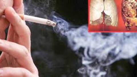 Hút thuốc lá chiếm đến 97% nguyên nhân gây ra ung thư phổi