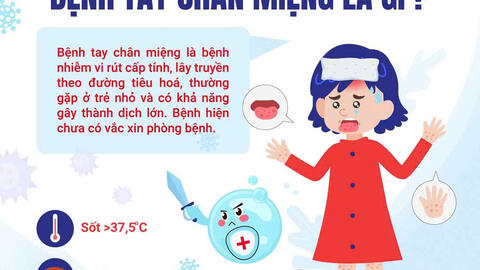 Những điều cần biết về bệnh tay - chân - miệng: