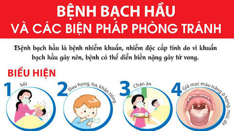 Bệnh Bạch hầu – Nguyên nhân, dấu hiệu và cách phòng chống