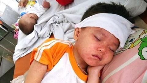 Phòng bệnh và chăm sóc trẻ mùa đông xuân