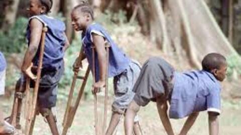 Tăng cường phòng, chống bệnh bại liệt