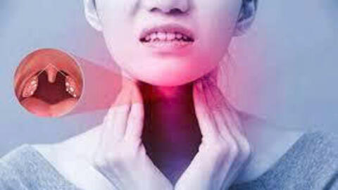 3 điều cần biết về chữa viêm họng đúng cách