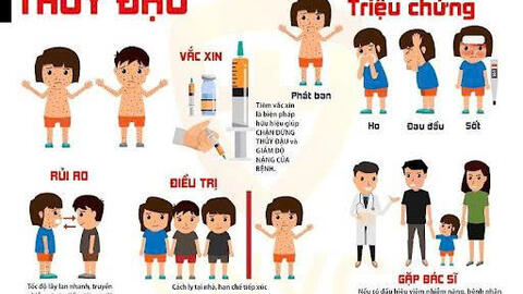 Những điều cần biết về bệnh thủy đậu và cách phòng tránh