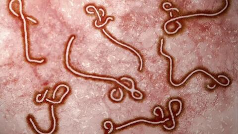 Bộ Y tế tăng cường giám sát trước nguy cơ dịch Ebola