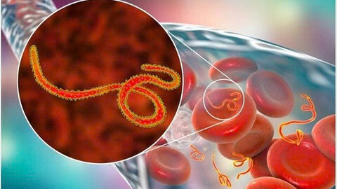 Chủ động phòng, chống dịch bệnh Ebola - Bảo vệ sức khỏe cộng đồng
