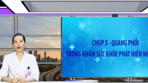 Video - CHỤP X - QUANG PHỔI TRONG KHÁM SỨC KHỎE PHÁT HIỆN NHỮNG GÌ