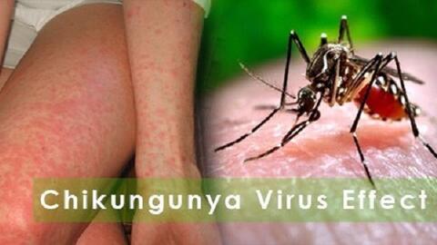 Dịch bệnh Chikungunya tăng tại nhiều nước, Bộ Y tế khuyến cáo khẩn các biện pháp phòng, chống
