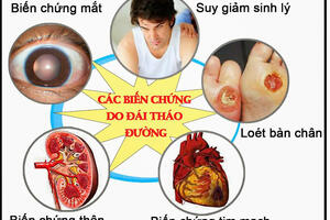 Bệnh đái tháo đường và cách phòng ngừa bệnh