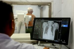 Khám sức khỏe định kỳ giúp phát hiện sớm bệnh lao trong cộng đồng