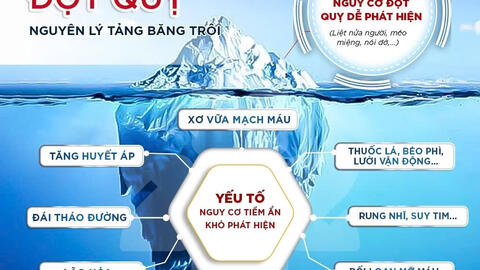 Các yếu tố nguy cơ đột quỵ và cách kiểm soát không dùng thuốc