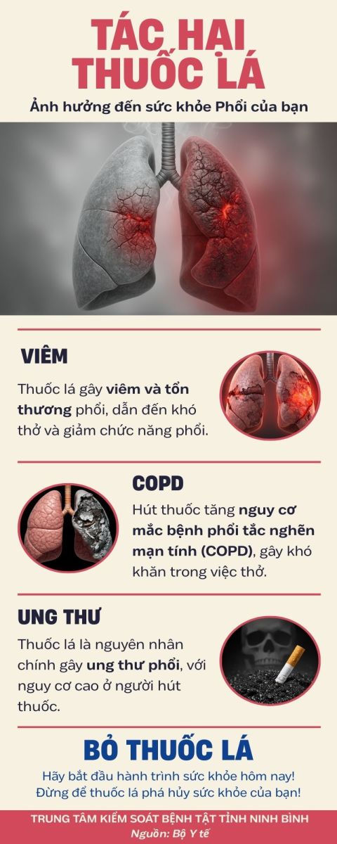 Hút thuốc lá là một nguyên nhân chính gây ra các bệnh phổi